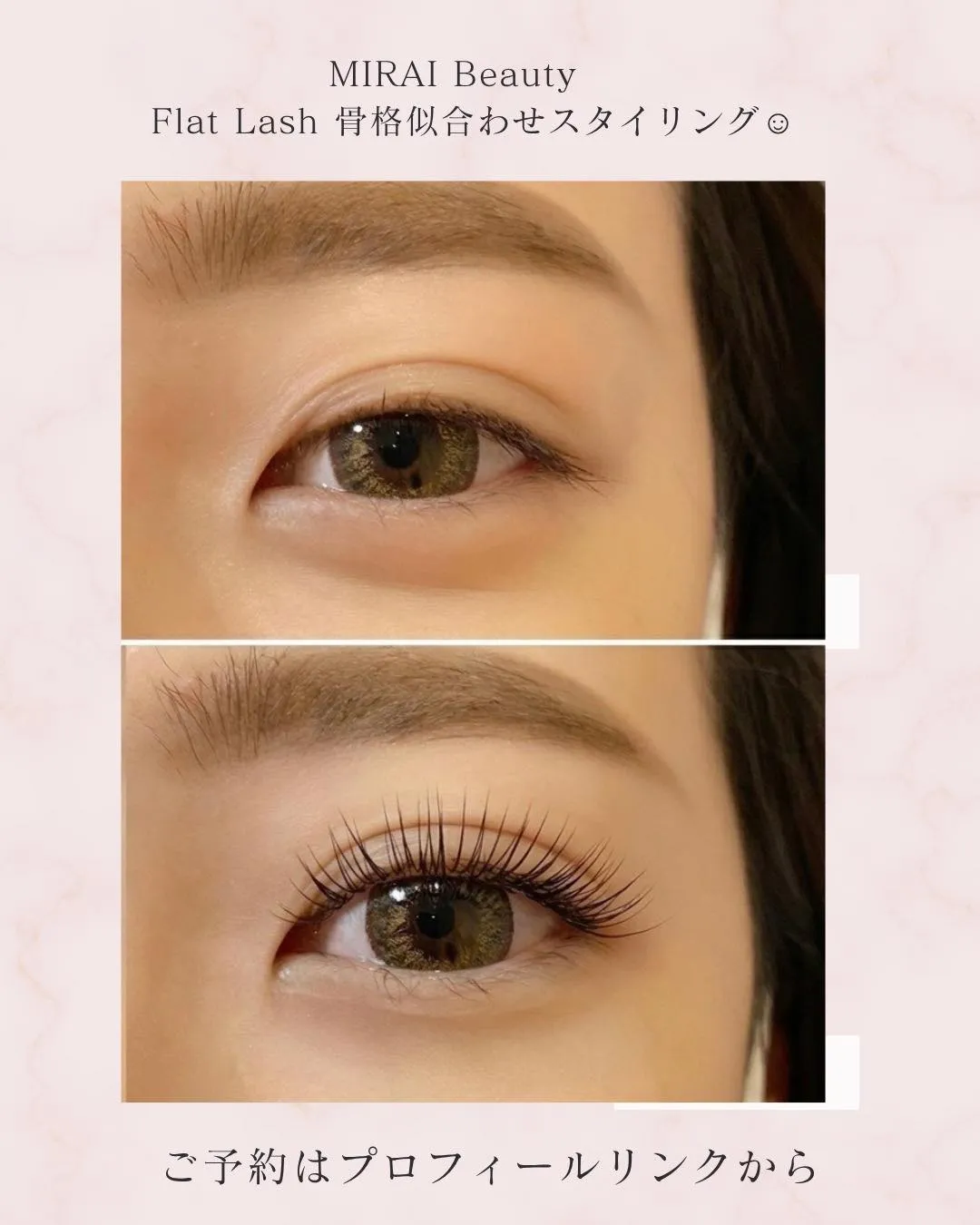 👀二重幅がしっかり見えるように、