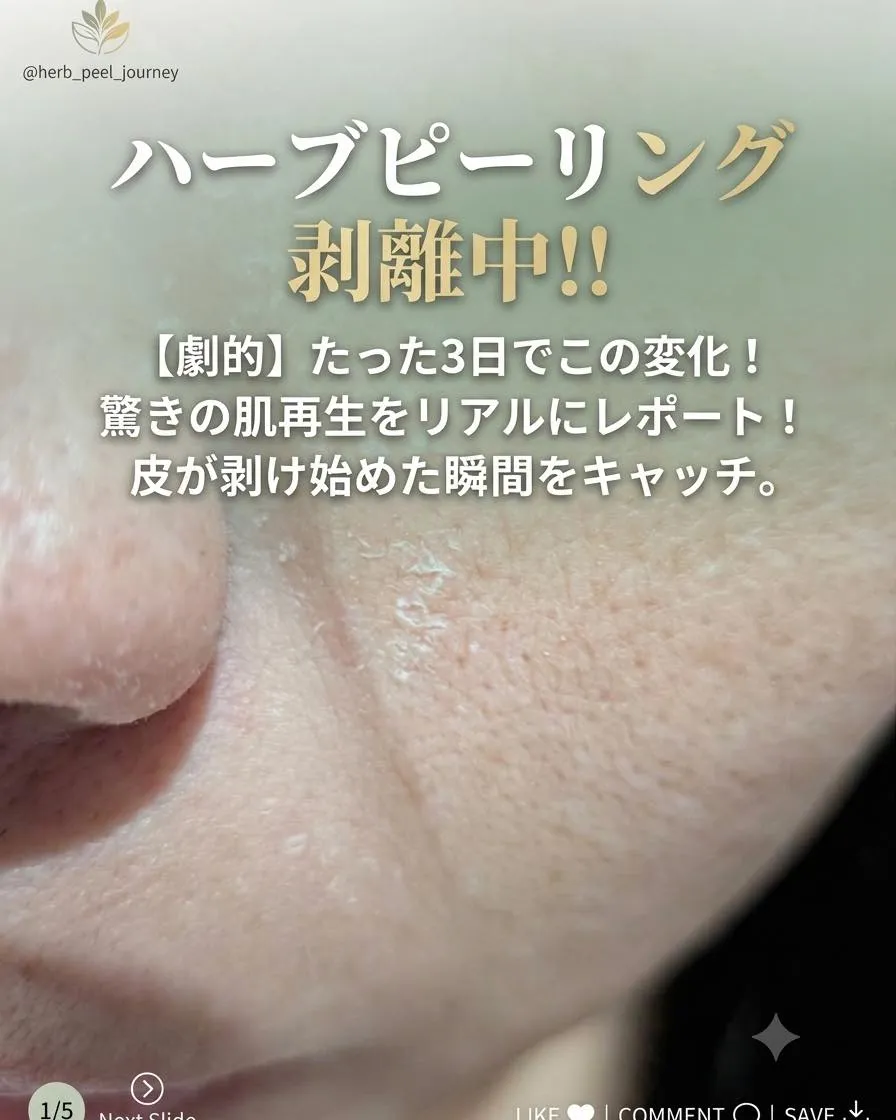【劇的】この変化✨✨✨