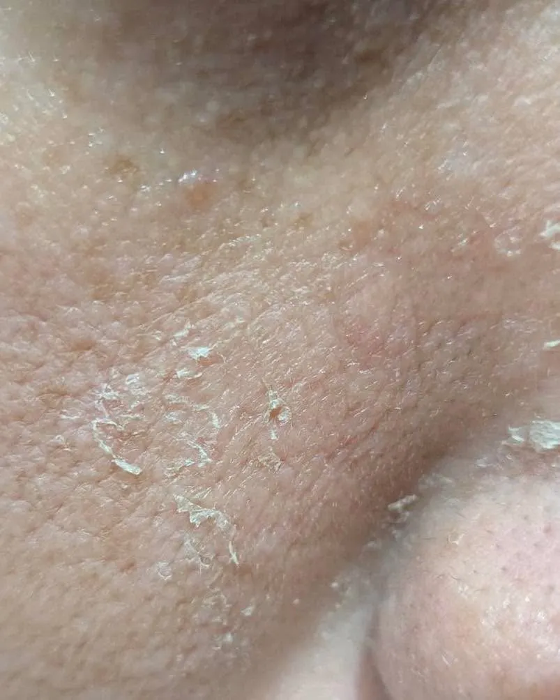 【劇的】この変化✨✨✨