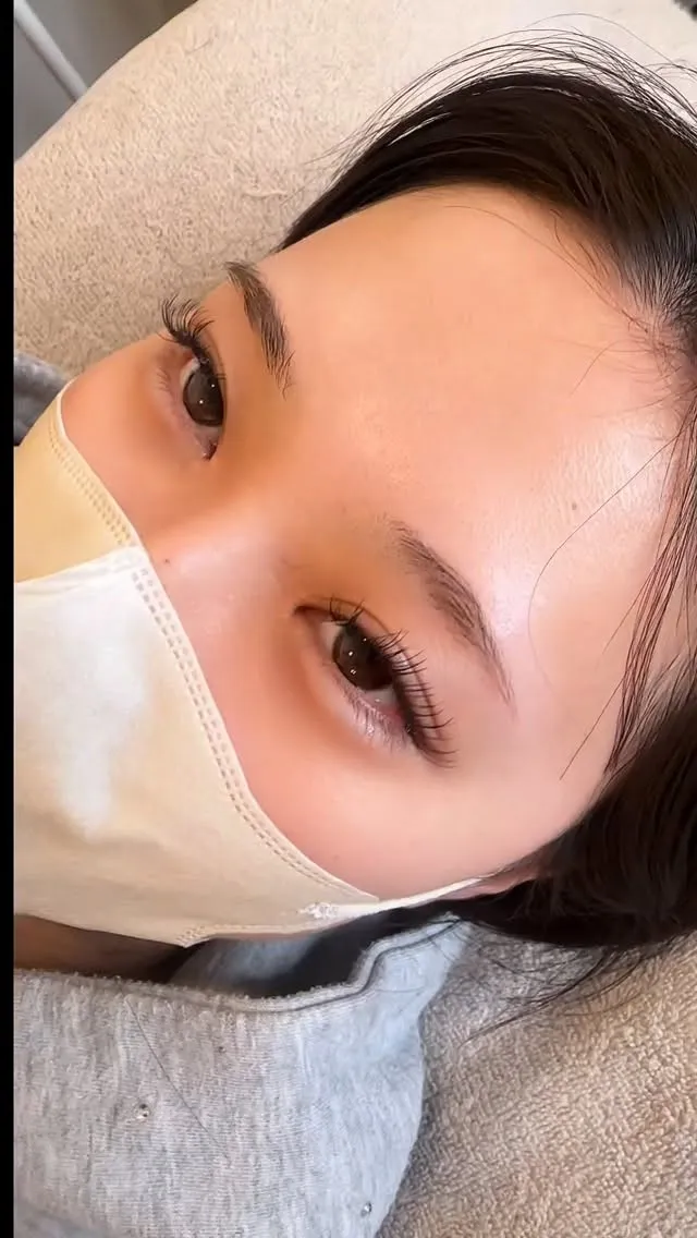 肌質、年齢のせいにしていませんか？